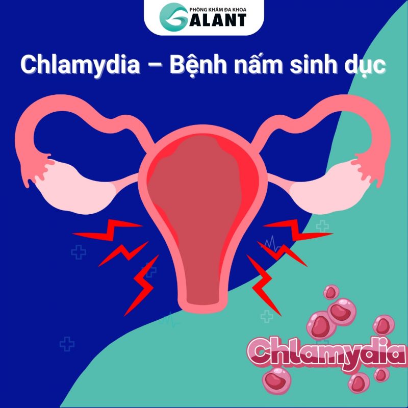 Chlamydia – Bệnh nấm sinh dục
