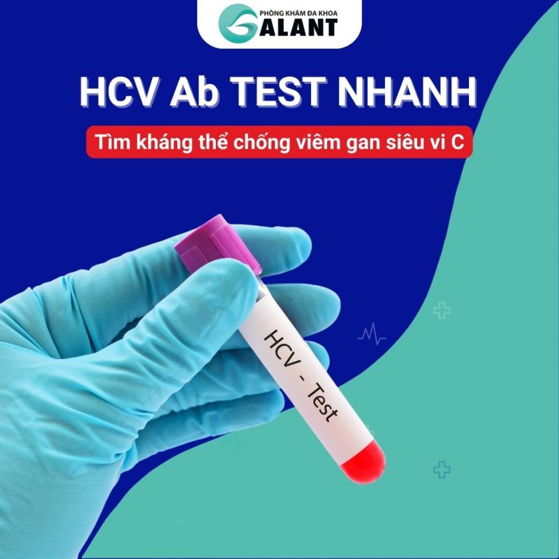 HCV Ab test nhanh – Tìm kháng thể chống viêm gan siêu vi C