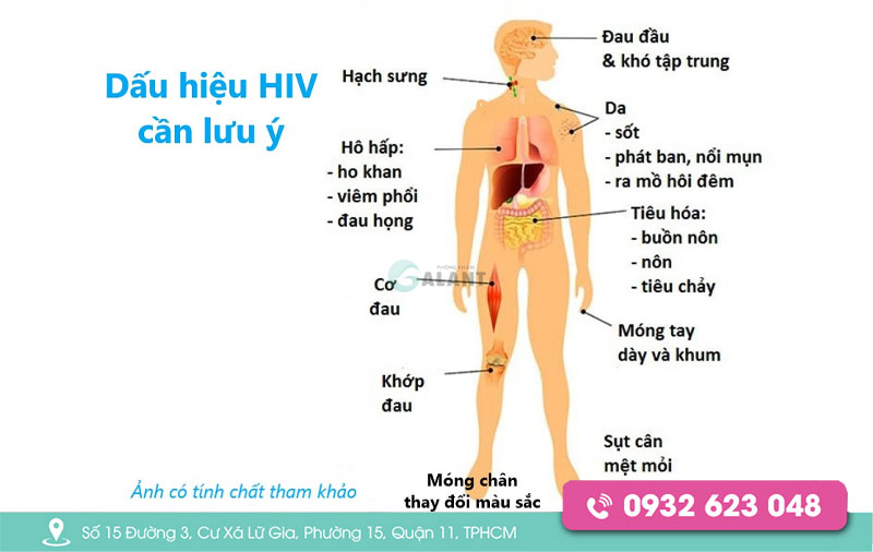 HIV có mấy giai đoạn, dấu hiệu của từng giai đoạn như thế nào