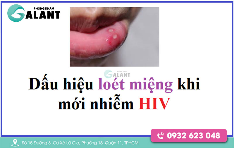 Viêm Loét Miệng Hiv