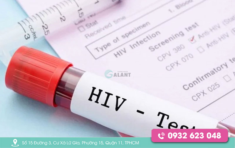 Xét Nghiệm Hiv Sau 8 Tuần Có Chính Xác Không