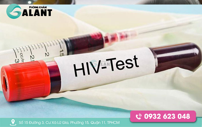 Xét nghiệm HIV sau 6 tháng có chính xác không