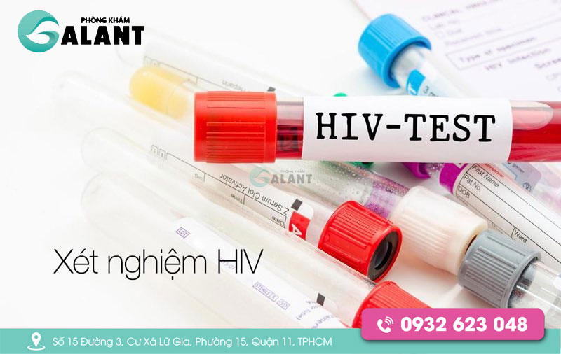 Xét nghiệm HIV sau 6 tháng có chính xác không