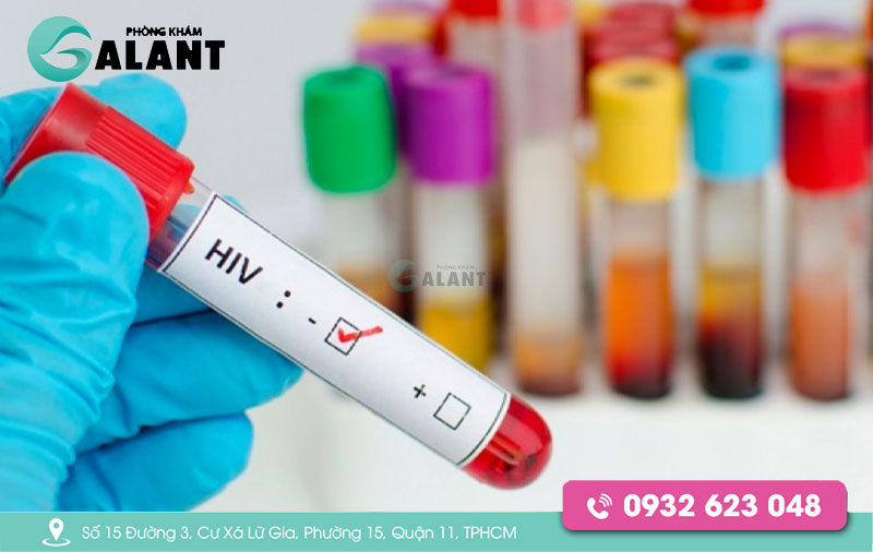 Test nhanh HIV sau bao lâu thì chính xác
