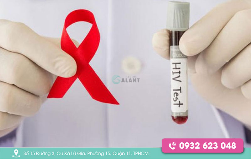 Test nhanh HIV sau bao lâu thì chính xác