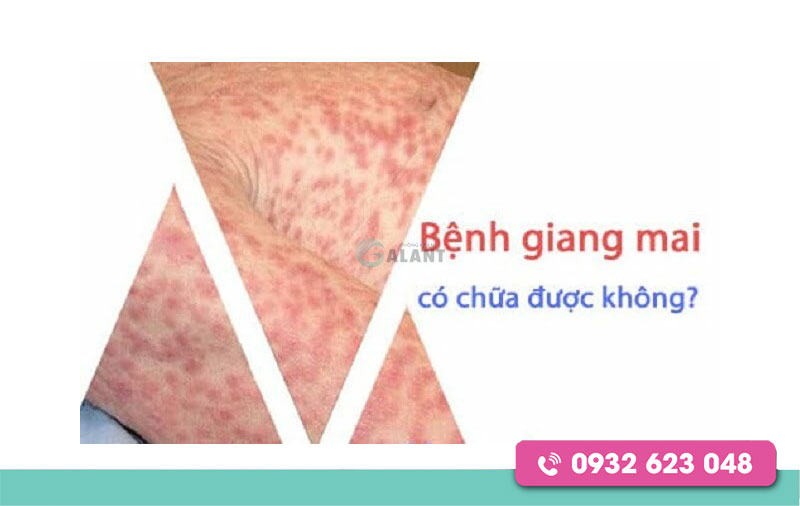 Bệnh giang mai và cách điều trị