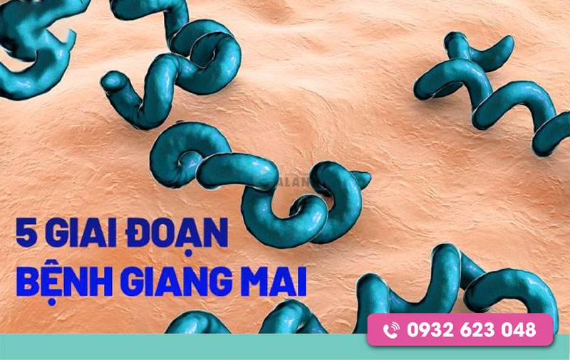 Giang mai có mấy giai đoạn